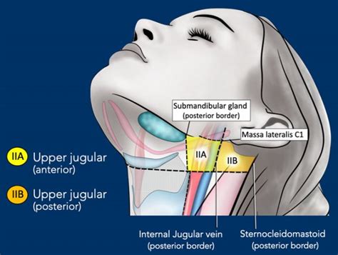 The Radiology Assistant : Cervical Lymph Node Map (2024)