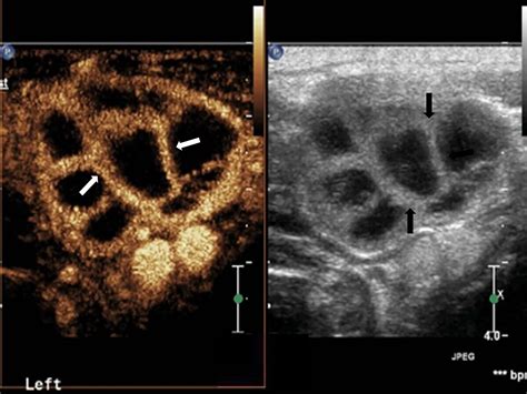 Frontiers | Reassessing the Value of Contrast-Enhanced Ultrasonography ...