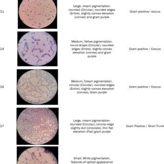 Results of Gram staining of protease enzyme bacteria which have the... | Download Scientific Diagram