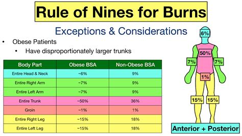 Rule of Nines for Burns: Child and Adult Chart, Calculator, Definition, Practice Examples — EZmed