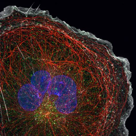 Super Resolution Spinning Disk Confocal Microscopy