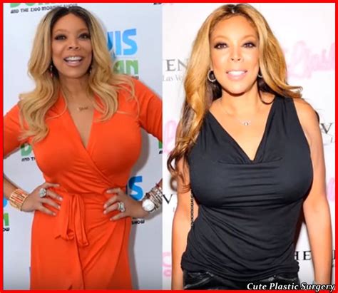 Wendy Williams Plastic Surgery - Celebrities Plastic Surgery