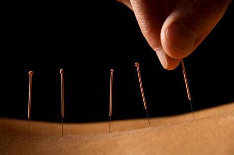 Acupuncture For Pain And The Secret Behind Its Effectiveness | Blog