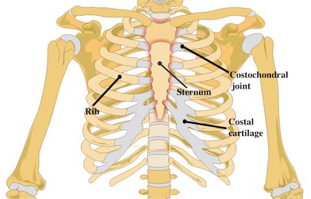 Costochondral Separation | Symptoms, Diagnosis & Treatment | Study.com