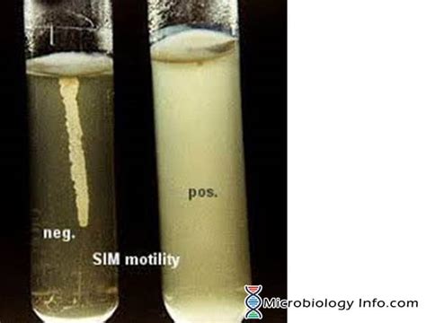 Motility Test - Principle, Procedure, Uses and Interpretation