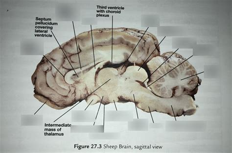 Mammillary Body Sheep Brain