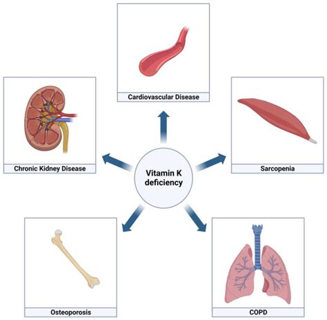 JCM | Free Full-Text | The Pleiotropic Role of Vitamin K in ...