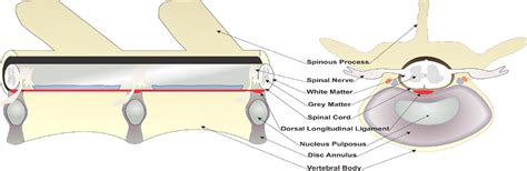 Anatomy Of Intervertebral Disc Disease, Dog Spinal Cord Anatomy - Safarivet