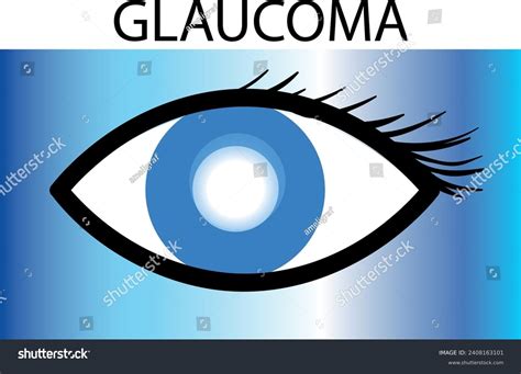 Various Types Eye Diseases Glaucoma Chalazion Stock Vector (Royalty Free) 2408163101 | Shutterstock