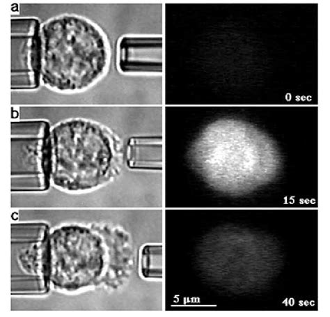 Pseudopod formation after the exposure of a single neutrophil to 10 −6... | Download Scientific ...