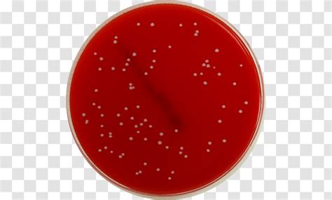 Salmonella On Xld Agar The Agar Used For Preparation Of Culture Media ...