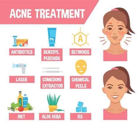 Everything About Acne-Prone Skin: Types, Causes & Remedies | Femina.in