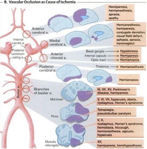 Cerebellar Stroke Syndrome