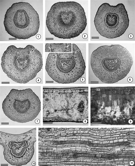 Cross-sections of the petiole (1–7), leaf (8–10), and longitudinal... | Download Scientific Diagram