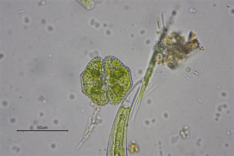 Cosmarium turpinii | The Microscopic Life of Shetland Lochs