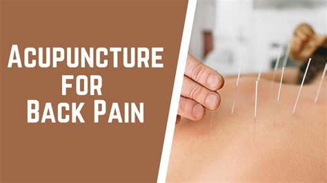 Acupuncture For Back Pain - YouTube