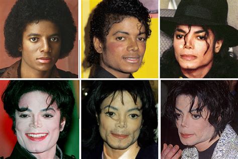 Michael Jackson's Plastic Surgery — See His Transformation