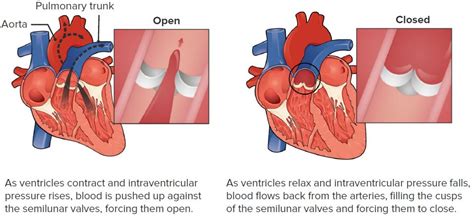 Pulmonary Regurgitation | Concise Medical Knowledge