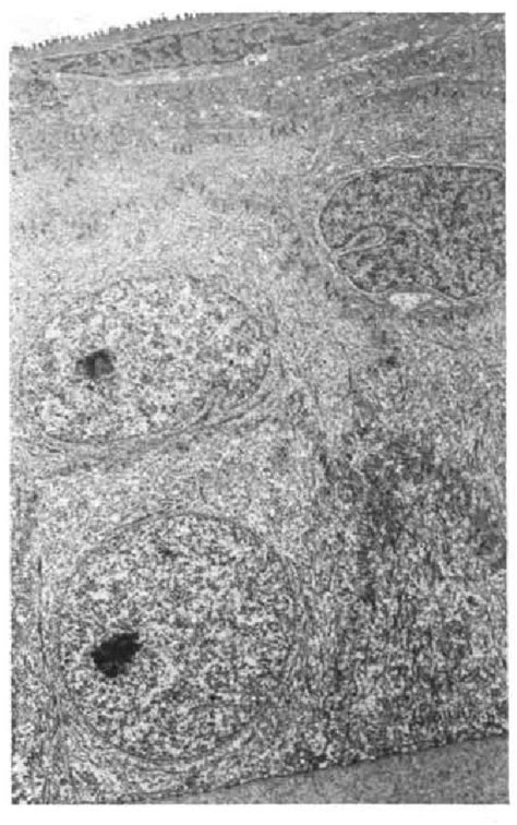 [PDF] The function of the corneal epithelium in health and disease. The Jonas S. Friedenwald ...