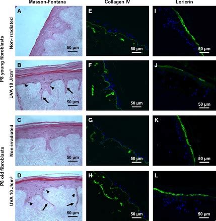 Reconstructed epidermis staining. Reconstructed epidermis was treated ...