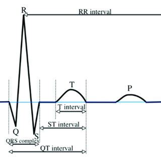 ECG signal features in the V5 lead. | Download Scientific Diagram