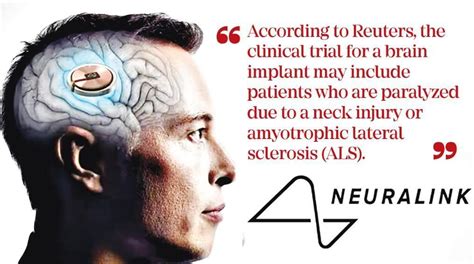 Neuralink to start human trial of brain implant for paralysis patients ...