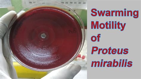 Proteus Mirabilis On Blood Agar