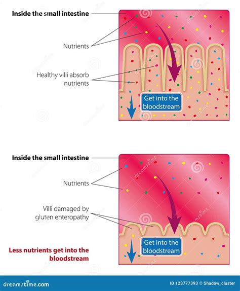 Absorption of Nutrients in the Small Intestine Stock Vector ...