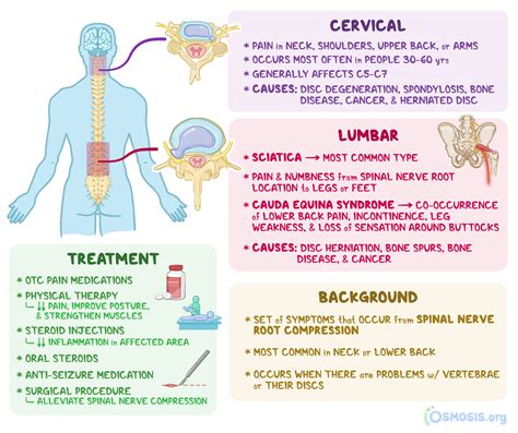 Radiculopathy: What Is It, Causes, Diagnosis, Treatment, and More | Osmosis