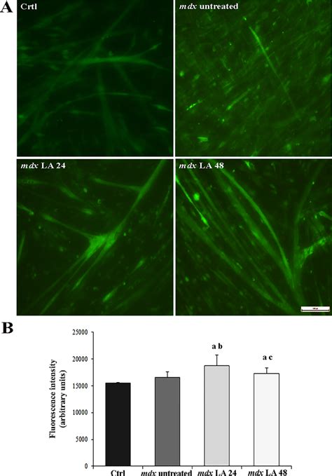 Intracellular calcium concentrations in control and dystrophic muscle ...