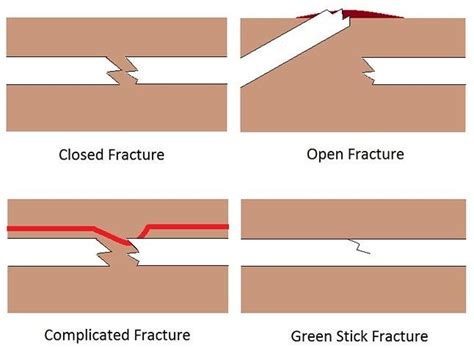 Fractures, Broken Bones and Dislocations - First Aid for Pets