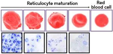 Understanding the diversity of immature red blood cells could help protect against malaria