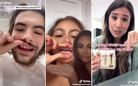 This Dentist Is Exposing The 'Shark Teeth' Veneers Trend On TikTok