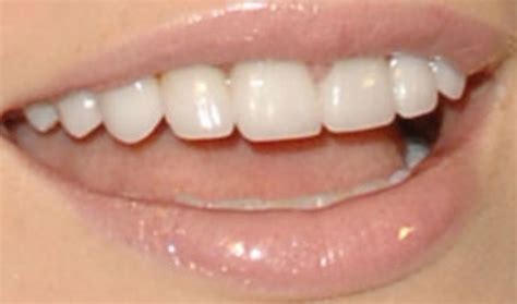 LeAnn Rimes Teeth Pictures