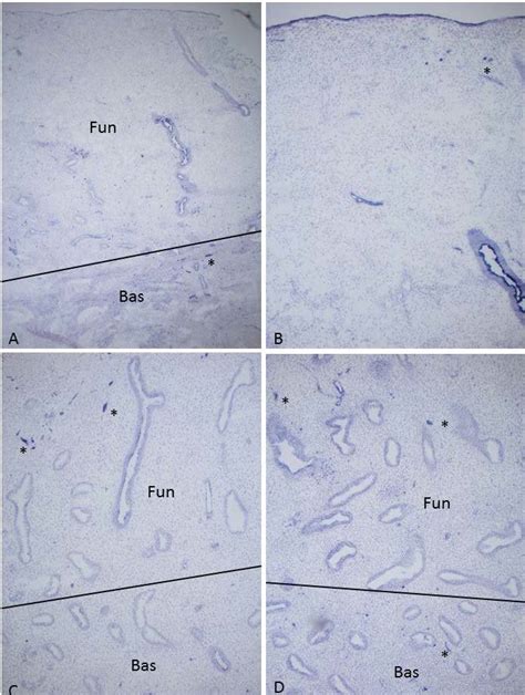 Early proliferative phase, Day 9, Case 4, (A) and (B) and... | Download Scientific Diagram