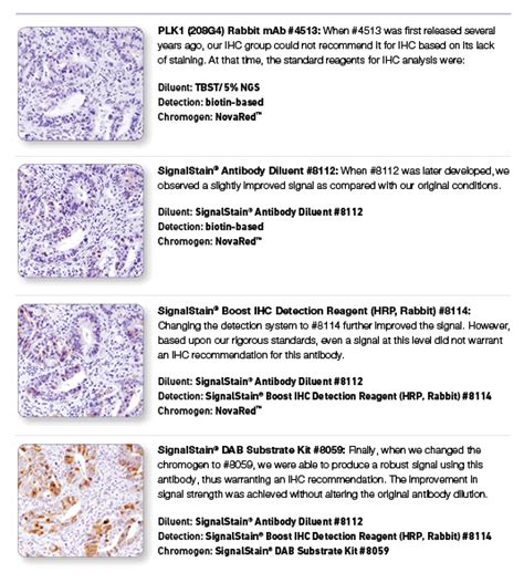 Understand how to analyse immunohistochemistry staining | Cell ...