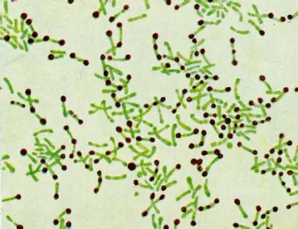 Cytoplasmic Granules in Bacteria • Microbe Online