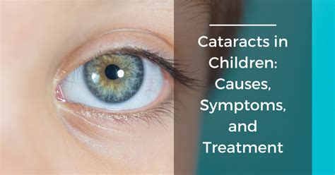 Cataracts in Children: Causes, Symptoms, and Treatment