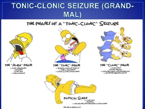 APPROACH TO SEIZURE CME