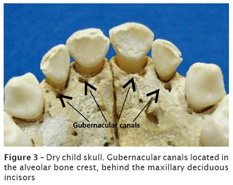 Gubernacular cord and canal: does these anatomical structures play a role in dental eruption?