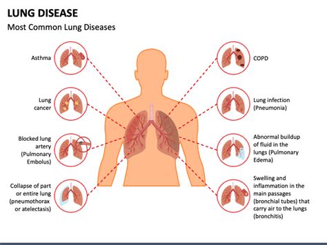 Lung Disease PowerPoint and Google Slides Template - PPT Slides