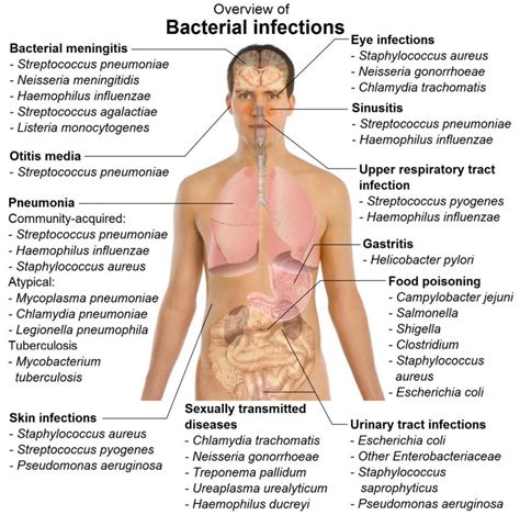 Overview of bacterial infections in human and main species involved. 12 ...