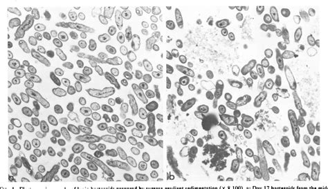 Figure 1 from Preparation and Fractionation of Rhizobium Bacteroids by ...