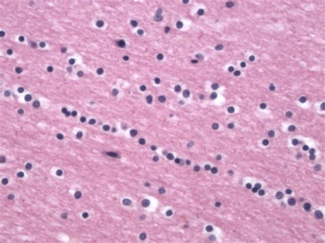 Oligodendrocyte Histology