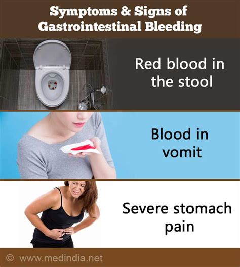 Gastrointestinal Bleeding Gi Bleed Causes Symptoms And Signs ...