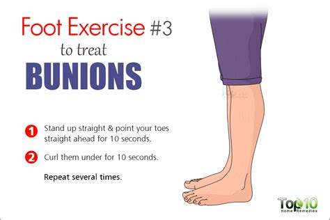 Home Remedies for Bunions | Top 10 Home Remedies