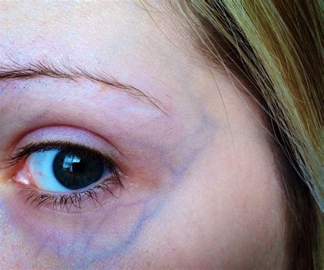 Makeup To Cover Spider Veins On Nose - Mugeek Vidalondon