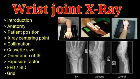 X Ray Wrist Lateral View