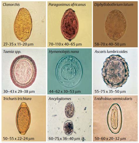 Eggs of Human Protozo in stool | Clinical Laboratories science | Pinterest | Stools ...