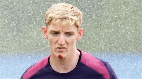 England player Anthony Gordon falls off his bike and gashes chin at ...